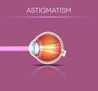 Can LASIK eye surgery fix astigmatism and can you have LASIK with astigmatism?