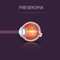 Can LASIK fix presbyopia - laser eye surgery for presbyopia