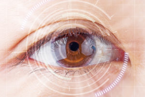 What Are the 3 Types of Cataracts