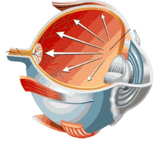 What is a Glaucoma Suspect?