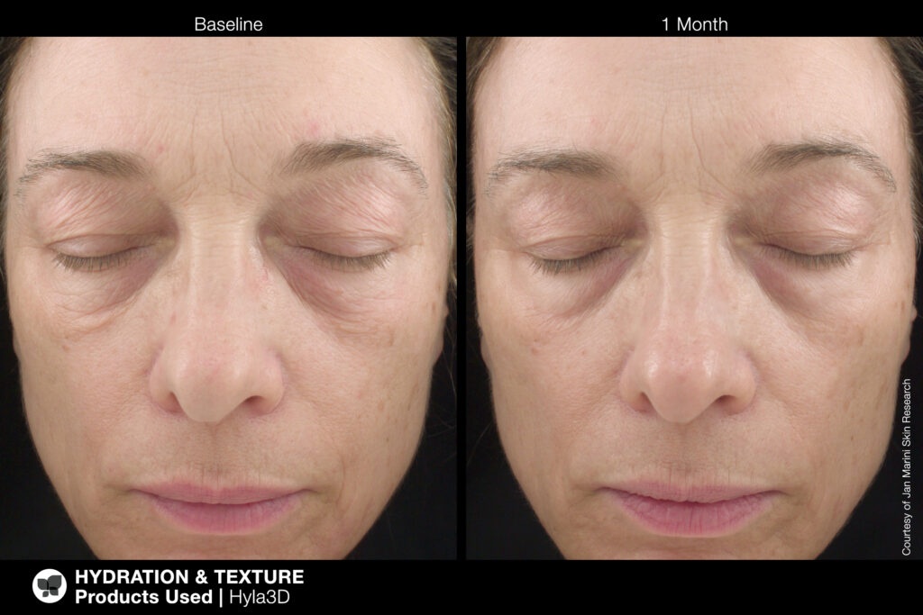 Jan Marini Skin Research Before and After
