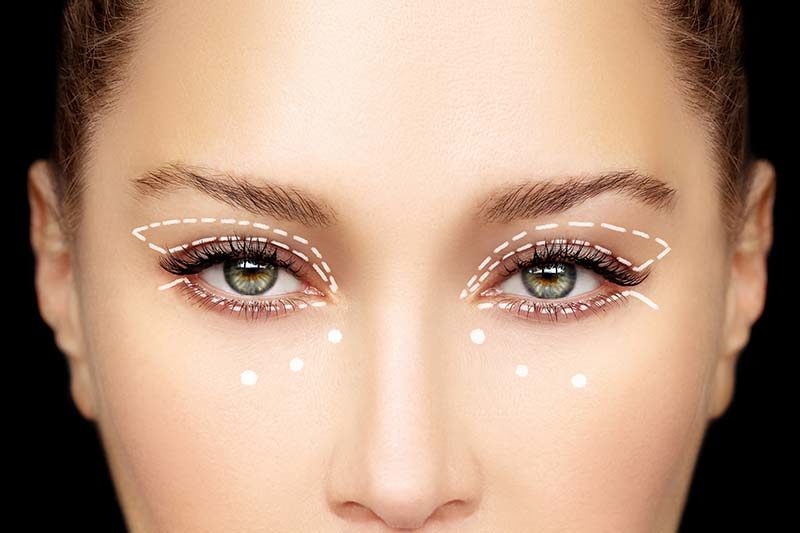 How to Treat Dark Circles - Plastic Surgeons Chevy Chase