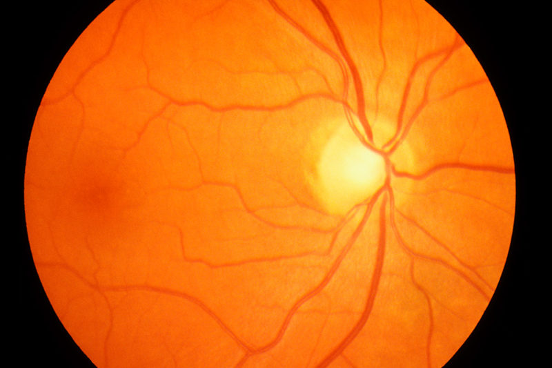 retina purpose - what does the retina do?