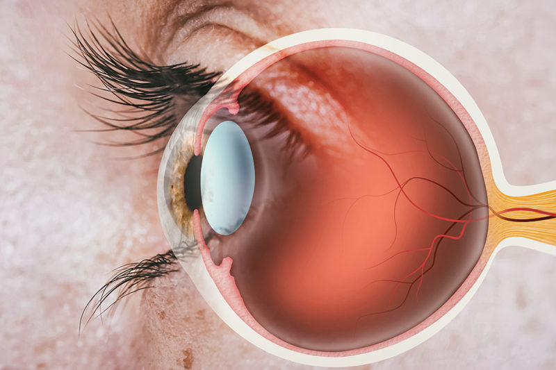 Cataract Surgery Doctors Washington DC - Best Cataract Surgeons